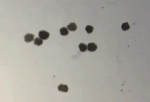 Anthrobots How Tiny Robots Made from Human Cells Are Revolutionizing Medicine